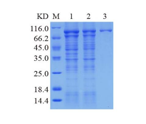Lane M: Protein Marker<br />Lane 1: Un-purified<br />Lane 2: Flow through<br />Lane 3: Elution